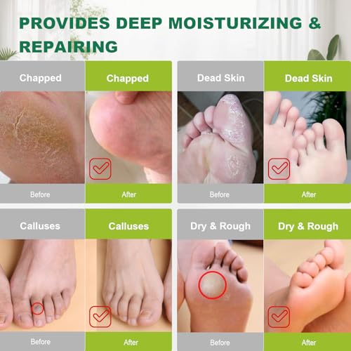 300 Pack Disposable Plastic Foot Covers for Pedicure & Paraffin Wax Treatment