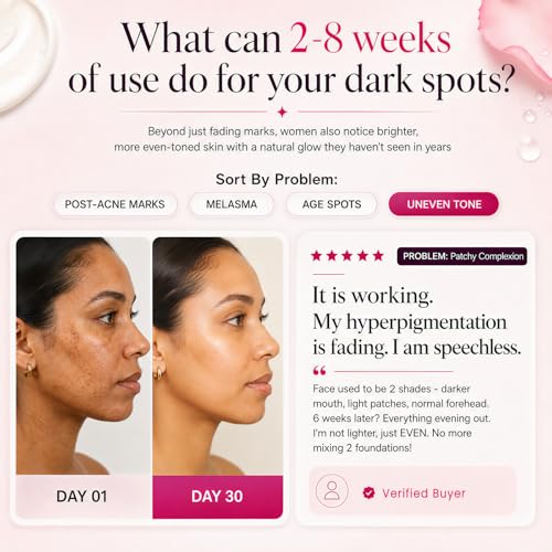 Seora Skins Brightening Cream with Arbutin & Tranexamic Acid