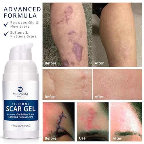 100% Silicone Scar Gel 2 Pack: 2 x 1.06oz Tubes for Surgical Scars, C-Section, Acne, Keloids, Burns, Stretch Marks ? Advanced Scar Treatment for Old & New Scars
