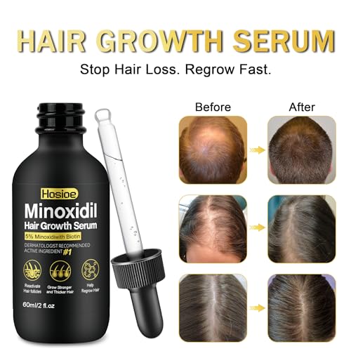 5% Minoxidil Hair Growth Serum for Men & Women - 3 Pack