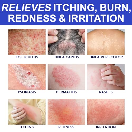 Salicylic Acid Acne & Folliculitis Cream 100g
