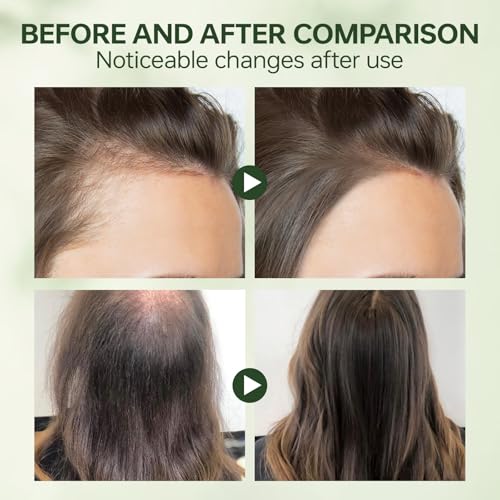Korean Scalp Revival Shampoo Bar - Deep Hydrating Hair Care