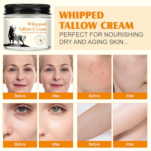 Beef Tallow for Skin - Tallow and Honey Balm for Face - 100% Grass-Fed Beef Tallow, Honey & Beeswax, Deep Hydration for Dry & Aging Skin, Natural Barrier, Nourishing Moisturizer