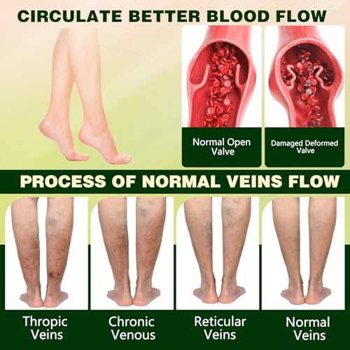 LHBMET Professional Leg Circulation Cream - Edema Relief & Skin Soothing, 1PC