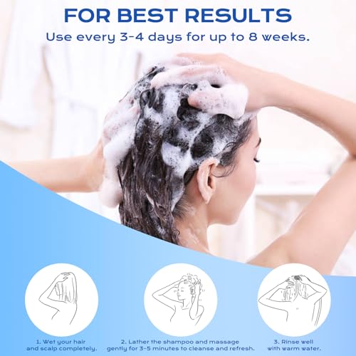 FYZMTL 1% Ketoconazole Anti-Dandruff Shampoo 6.75 Fl Oz Scalp Treatment for Itchy Flakes