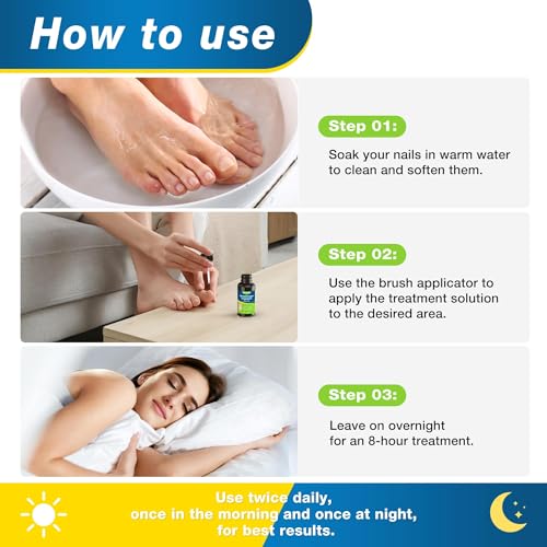 Extra Strength Toenail Fungus Treatment with 25% Undecylenic Acid - 30ml