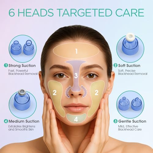 VOYOR Blackhead Remover Pore Vacuum - 6 Heads, 3 Modes