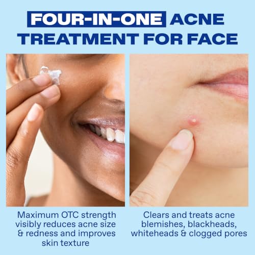 Differin 10% Benzoyl Peroxide Acne Spot Treatment, 1 oz