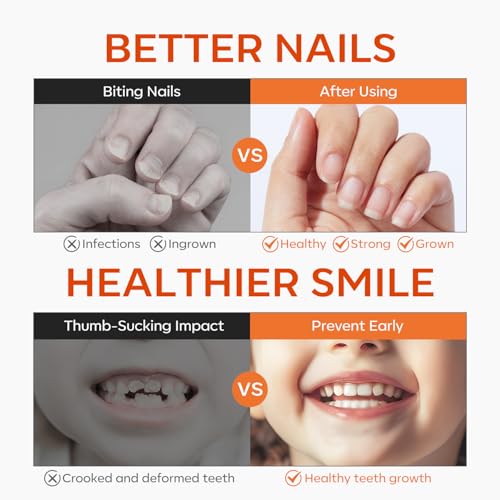 Modelones Anti Nail Biting Polish & Bitter Thumb Sucking Deterrent, 0.48 fl oz