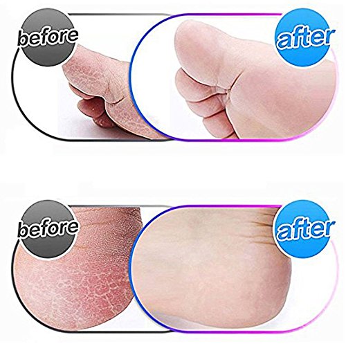 12 Pack Extra Coarse Replacement Rollers for Foot File