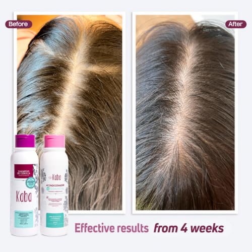 Onion Shampoo and Conditioner Kit with Ceramides
