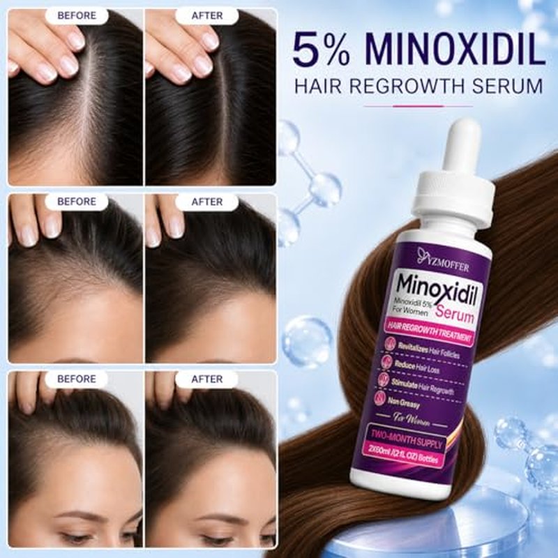 5% Minoxidil Hair Regrowth Treatment for Women - 2-Month Supply