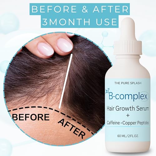 B-Complex Hair Serum with Caffeine & Copper for Stronger Hair