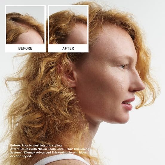 Nioxin Scalp + Hair Thickening Kit for Natural & Colored Hair