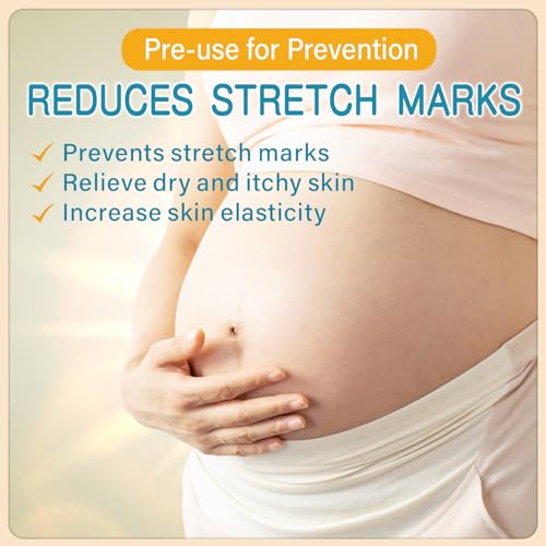 PEGO Stretch Mark Cream for Pregnancy,Prevention Belly Cream,Belly Oil for Pregnant Women,Moisturizing Body Cream,Prevent & Reduce Stretch Marks,Non-irritating 300g/10.1Fl Oz