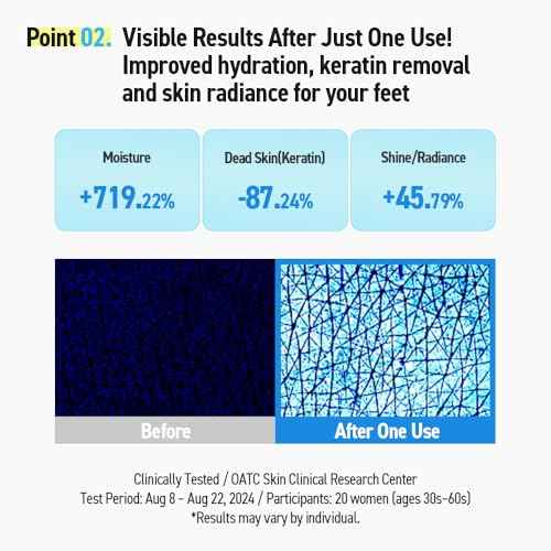 Silky Coconut Oil Foot Mask ? 5 or 10 Pairs Hydrating Booties for Dry, Cracked Feet | Nourishing, Moisturizing & Walkable | Spa Foot Treatment at Home (10 Pair (Pack of 2))