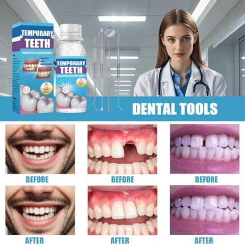 Tooth Repair kit with 4 Dental Tools, temporary tooth filling kit, tooth replacement missing teeth, Save Smile Cause Bad Teeth and Smile Confidently Again