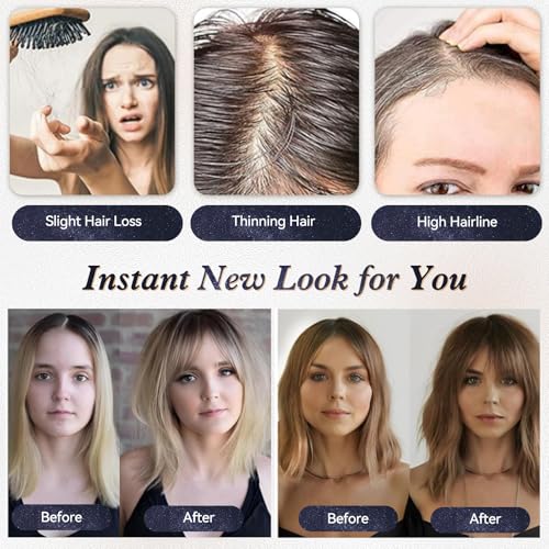 Starluck Hair Topper for Women - 100% Remy Human Hair, 12" Ash Blonde