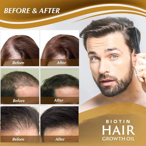 Biotin Hair Growth Serum with Ginseng & Ginger
