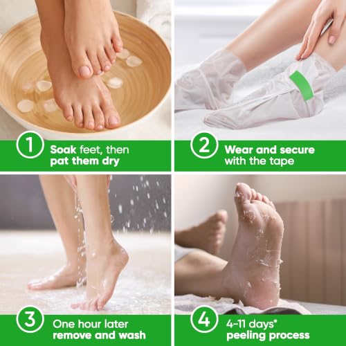 CÉLOR Foot Peel Mask for Dead Skin & Callus Removal - Aloe Vera & Nourishing Ingredients, 2 Pairs