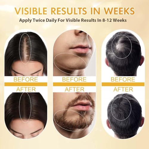 5% Minoxidil Hair Regrowth Spray for Thicker, Stronger Hair