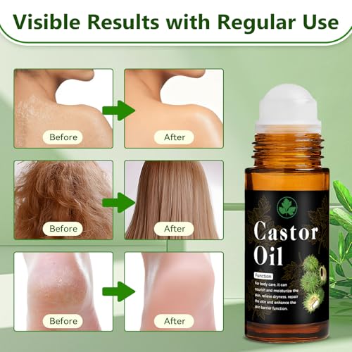 Organic Castor Oil Roll On ? 30ml (1 fl. oz) Pure Cold Pressed Roll On Castor Oil Organic, Castor Oil Roller Ball for Skin, Scalp, Neck, Hands, Joints, Waist & Belly Moisturizing Care