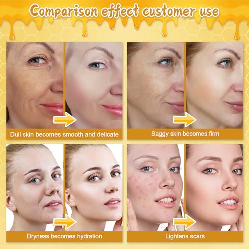 Bee Venom Skin Cream, New Upgrade 2pcs 60g Multipurpose Bee Venom Skin Treatment Cream for Repair, Moisturize and Lift