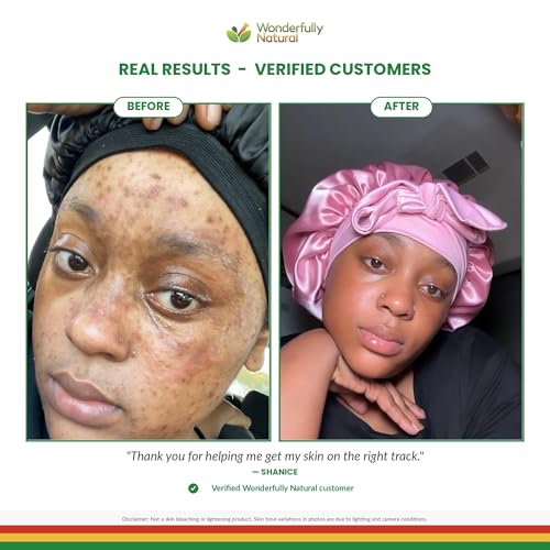 Organic African Black Soap Bar for Acne & Dark Spots