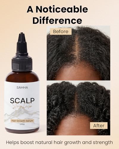 Sahha Hair Growth Oil - Scalp Stimulator for Fuller Hair, 2 Fl Oz