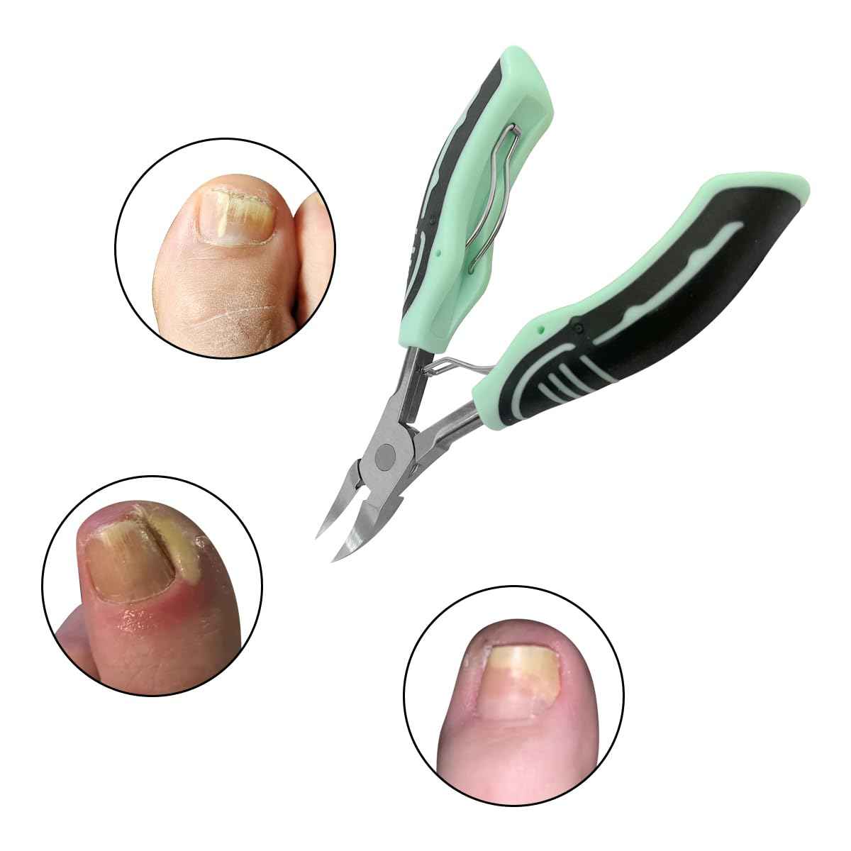 2Pack Cuticle Trimmer Cuticle Nippers, Clippers Pedicure Tool for Thick Ingrown Nail Care Pedicure Manicure