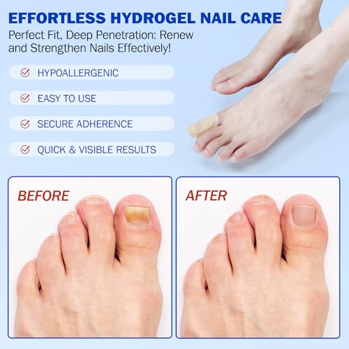 Nail Patches 24 PCS Overnight Toenail Treatment Extra Strength
