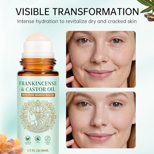 Frankincense & Castor Oil Roller - Rose Quartz, 50ml