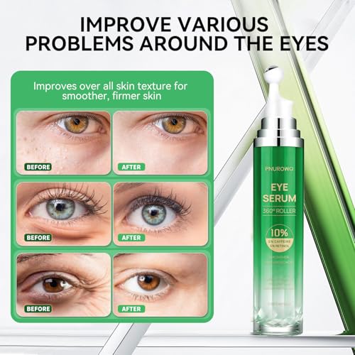 Caffeine & Retinol Eye Cream with 360¡Æ Roller - Hydrating & Anti-Aging Formula for Fine Lines, Puffiness, Dark Circles & Bags Moisturizing for Women & Men