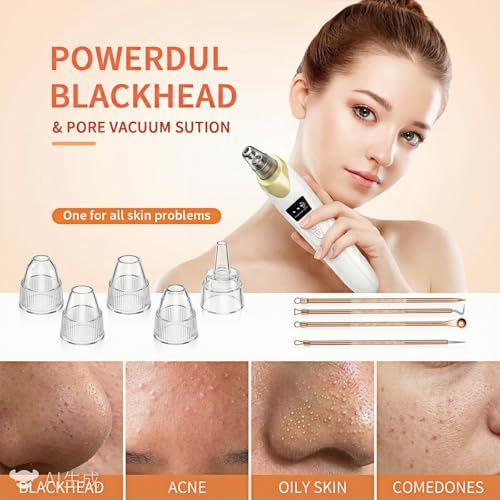 Echtur Electric Blackhead Remover with 5 Suction Heads