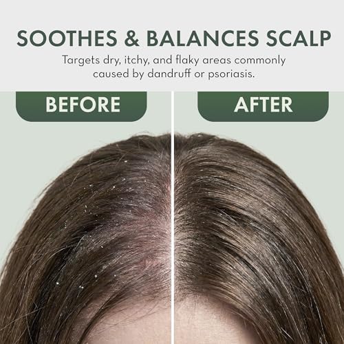 Tea Tree Leave-In Conditioner Spray – Anti-Dandruff Scalp Treatment (2 Pack)