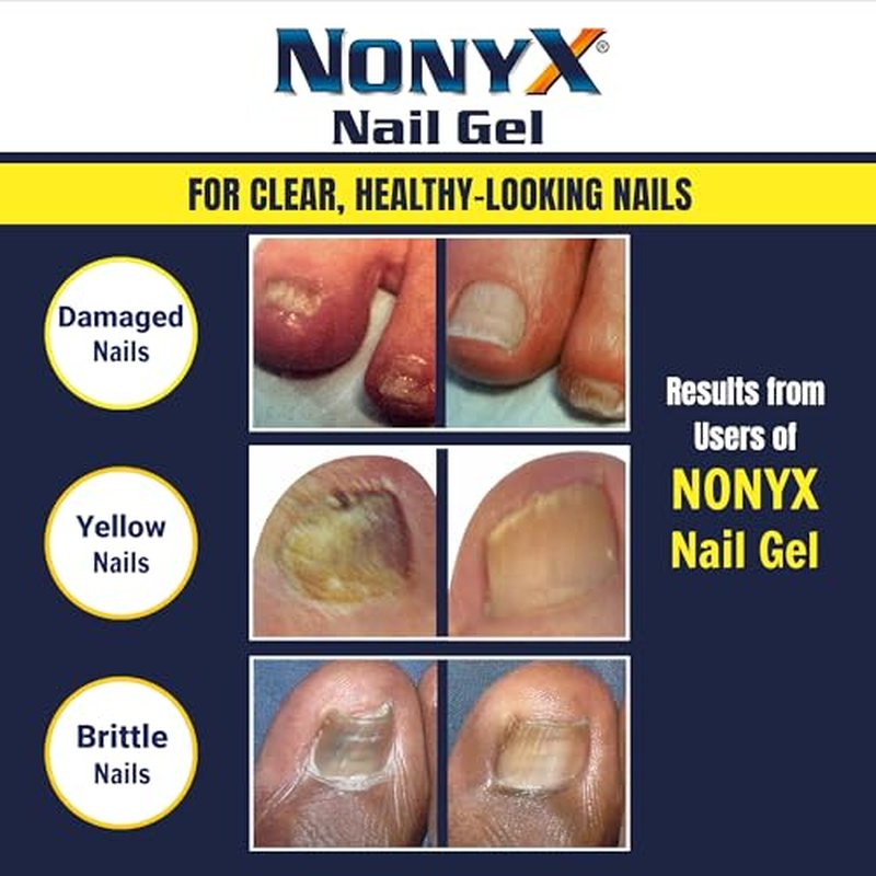 NONYX Fungal Nail Clarifying Gel – Clinically Proven for Thick, Yellow, Brittle Nails