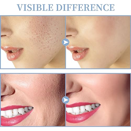 TUMAKOU High Frequency Facial Machine with 4 Glass Tubes