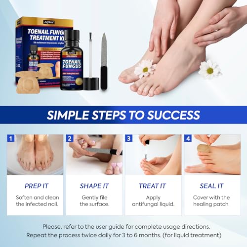 Toenail Fungus Treatment Kit with 25% Undecylenic Acid & Patches
