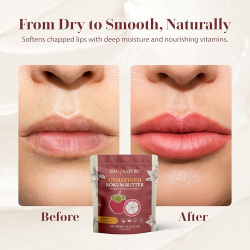 era of nature Kokum Butter Raw - 32 oz (2lb) ? Natural Butter for Body Butters, Lotion Bars, Lip Balm, Soap Making ? Blends Well with Shea or Cocoa Butter ? For Stretch Marks, Scars, Pregnancy Care