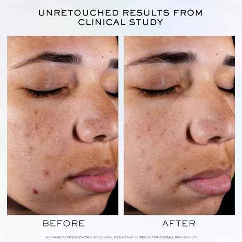 Lanc?me Clarifique Pro-Solution Face Serum - Facial Serum For Visibly Reducing Dark Spots & Acne Spots - With 10% PHA and Niacinamide