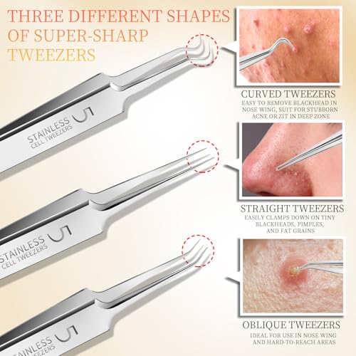 Blackhead Pimple Remover Tweezers Kit - 4 Stainless Steel Precision Tools