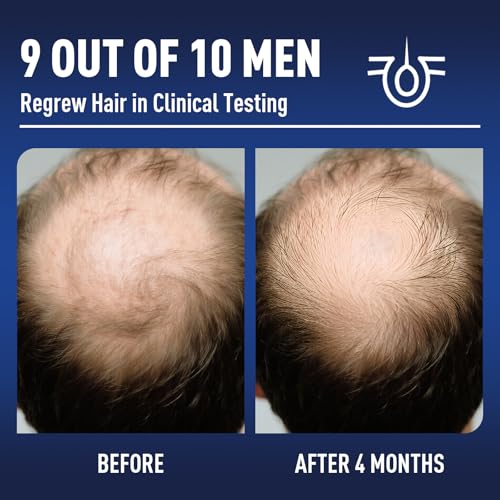 5% Minoxidil Hair Growth Liquid for Men & Women - 2 Pack