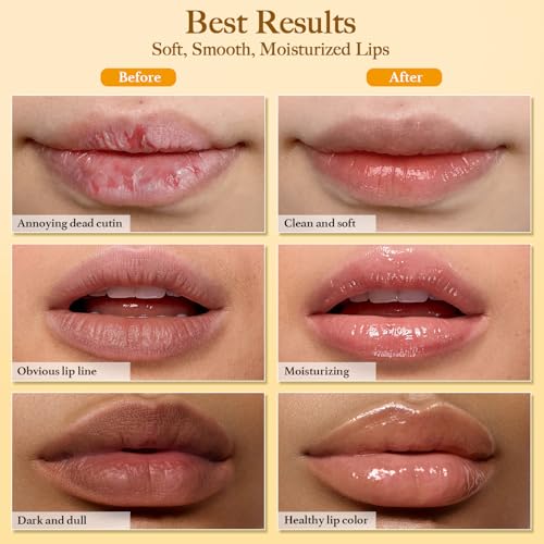 Turmeric Lip Scrub & Balm Set with Brush - Exfoliate & Moisturize