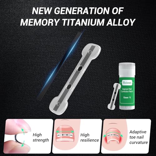 Ingrown Toenail Treatment Kit - Titanium Alloy Curved Nail Repair