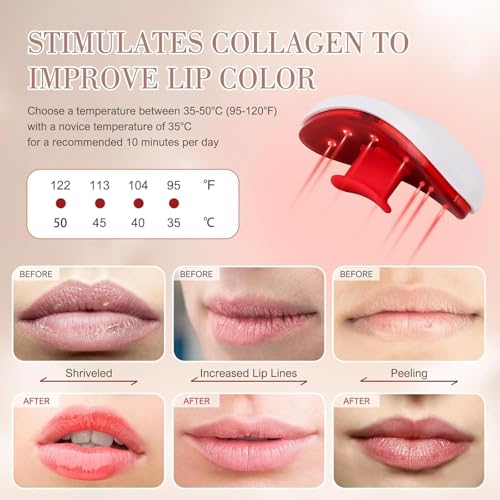 TsoLay Electric Lip Plumper with Suction Control & Timer
