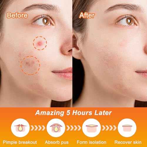Pimple Patches,Halloween Acne Patch,Pimple Patches for Face, Cute Stickers,Salicylic Acid & Tea Tree, 100PCS Hydrocolloid Dots in 8 Colors for Face,Cute Halloween Stickers