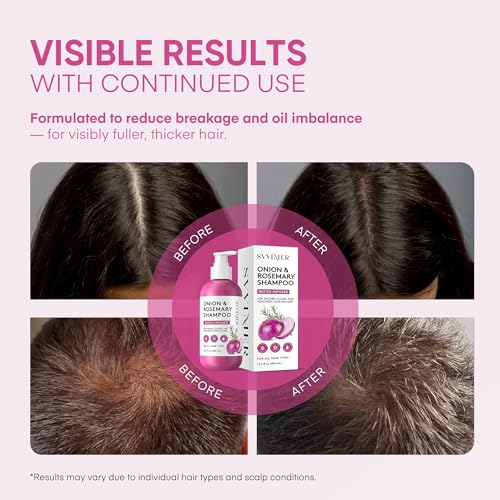 Svvimer Onion Rosemary Biotin Shampoo for Hair Growth, 13.5 Oz