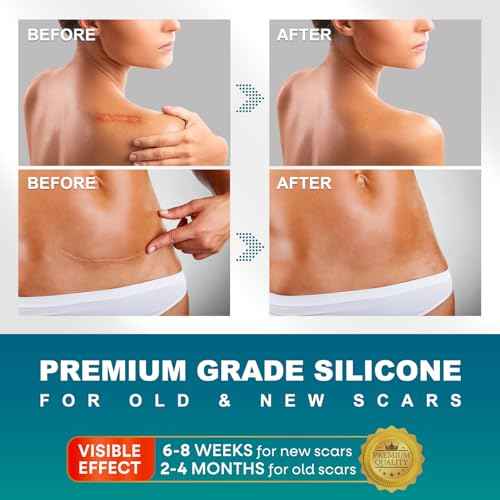 Silicone Scar Sheets, Silicone Scar Tape(1.6"x 120" Roll-300CM), Silicone Tape for Scars, Scar Tape for Surgical Scars, Silicone Scar Strips for C-Section, Tummy Tuck, Keloid, and Surgical Scars