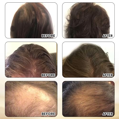 Miracle Elixir Collection Joyce Giraud Hair Strength Supplements 120 Capsules - Supports Hair Growth, Skin & Nails - 1 Pack