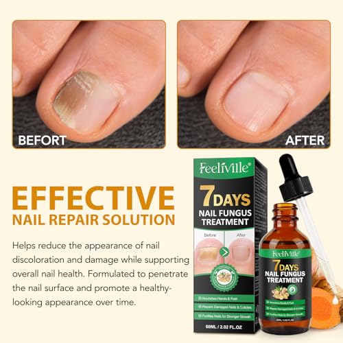 Ginger Nail Growth Serum - 60ml Strengthener Oil